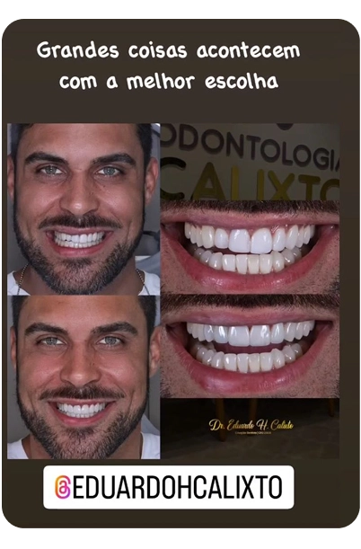 Depoimento 3